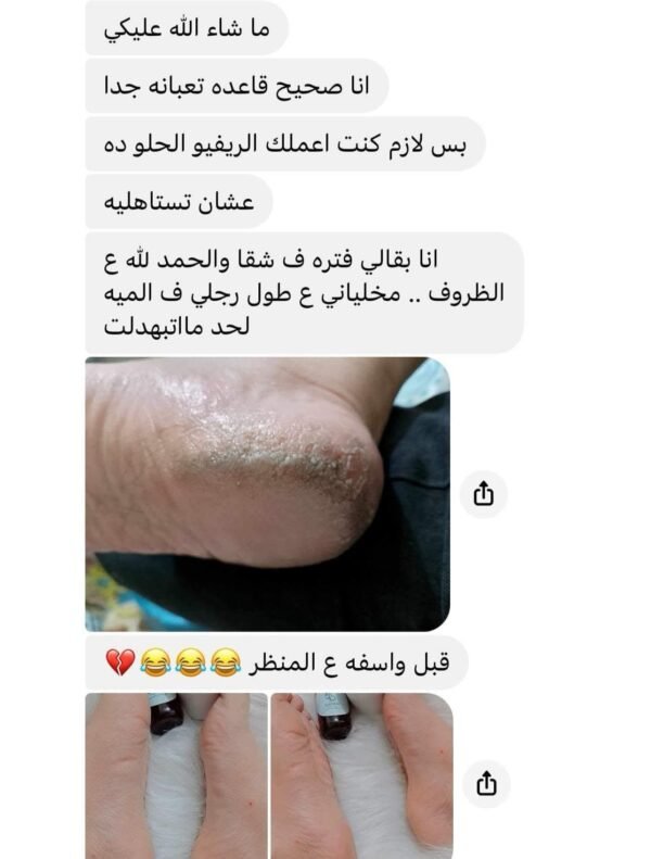 WhatsApp Image 2026-01-29 at 2.55.03 PM (1) مجموعة الباديكير