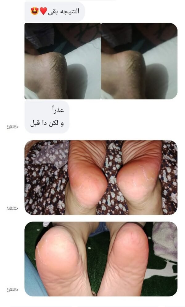 WhatsApp Image 2026-01-29 at 2.55.05 PM (3) مجموعة الباديكير